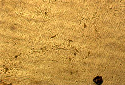 Hyphen von Aphanomyces astaci unter Mikroskop