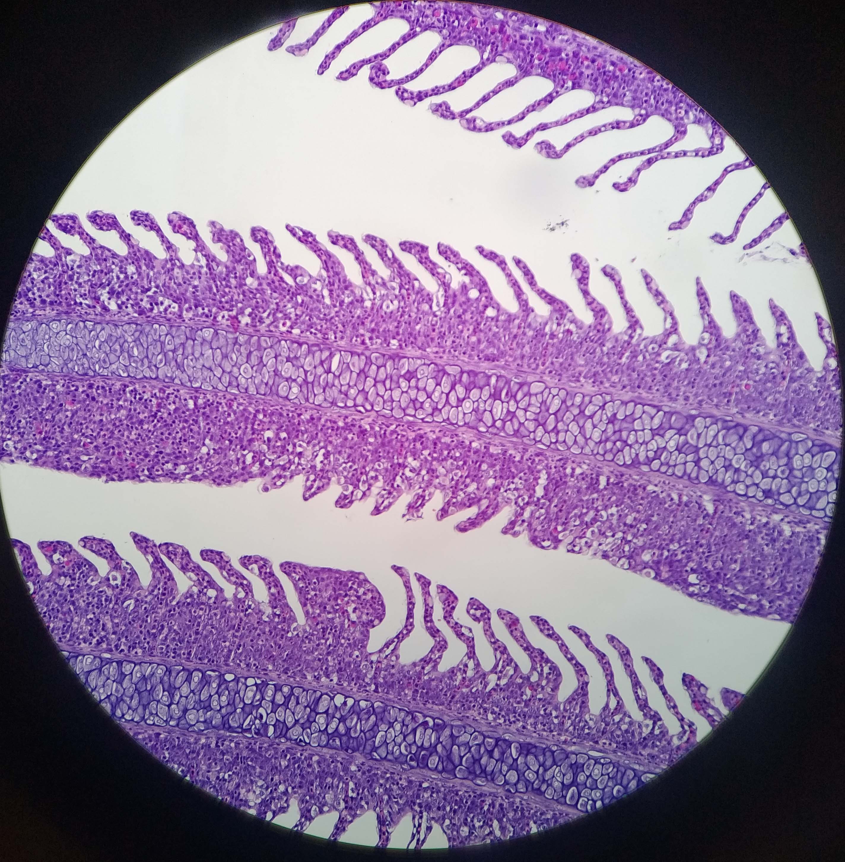 Histologie: Kiemenepithelproliferation