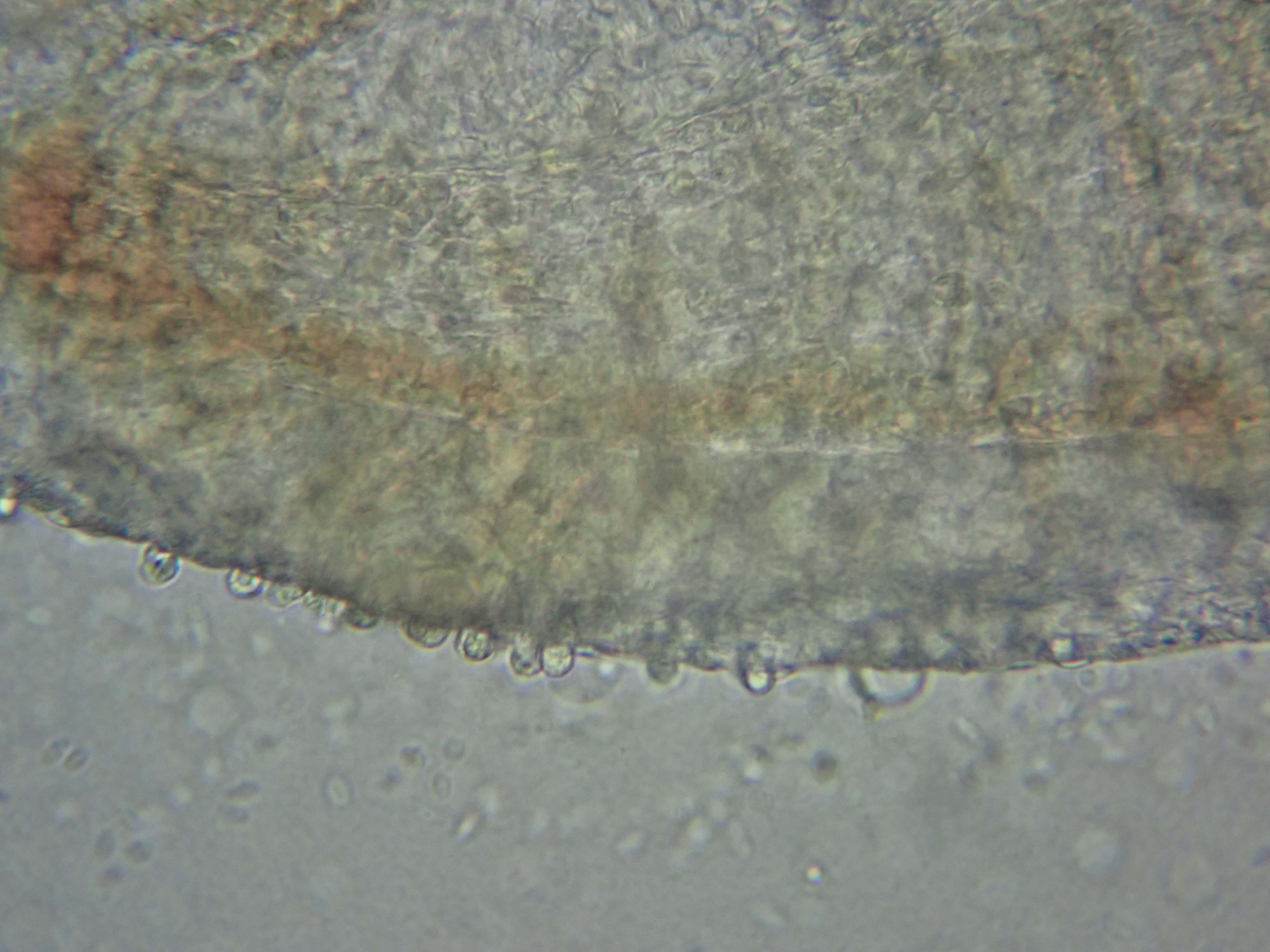 Amoeben auf den Kiemenoberfläche an Mikroskop