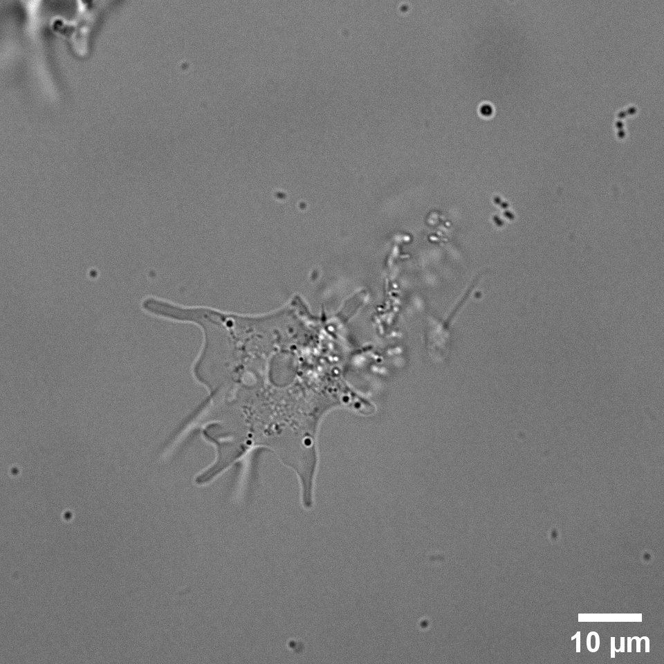 Microscopic image of an Amoeba, magnified 600x